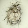 Walking Mite Under Microscope